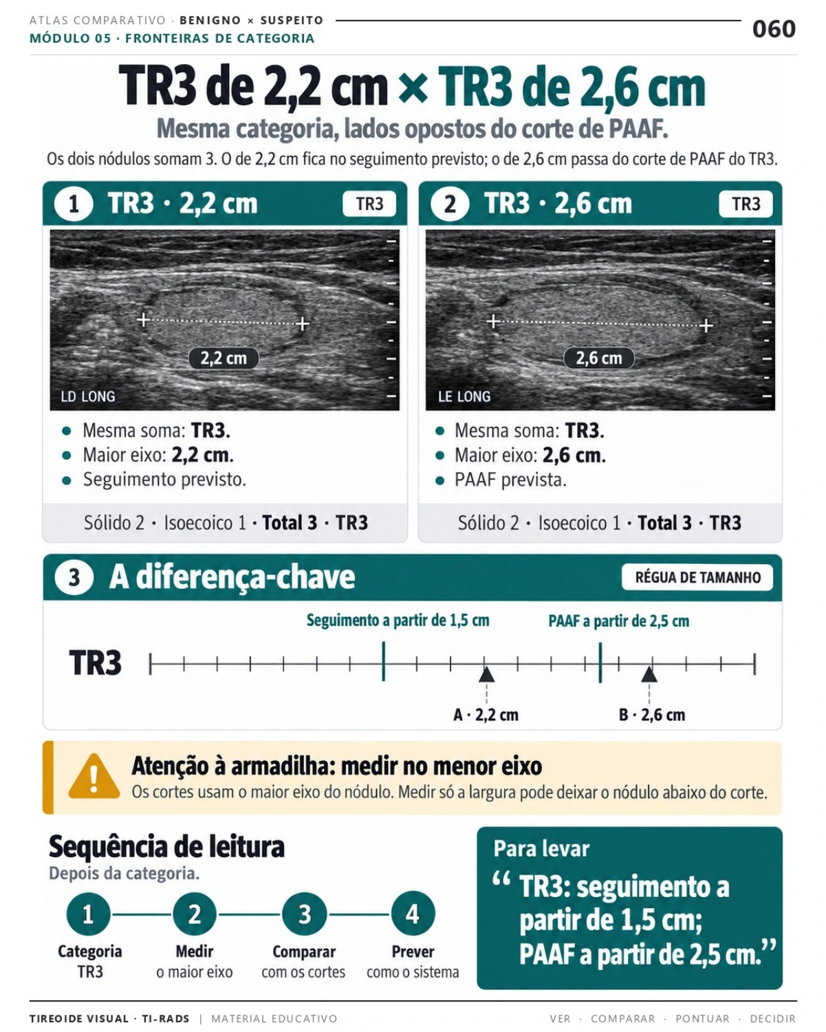 Página 60: Mesma categoria, tamanhos diferentes. Prévia do PDF Tireoide Visual TI-RADS; imagens didáticas simuladas.