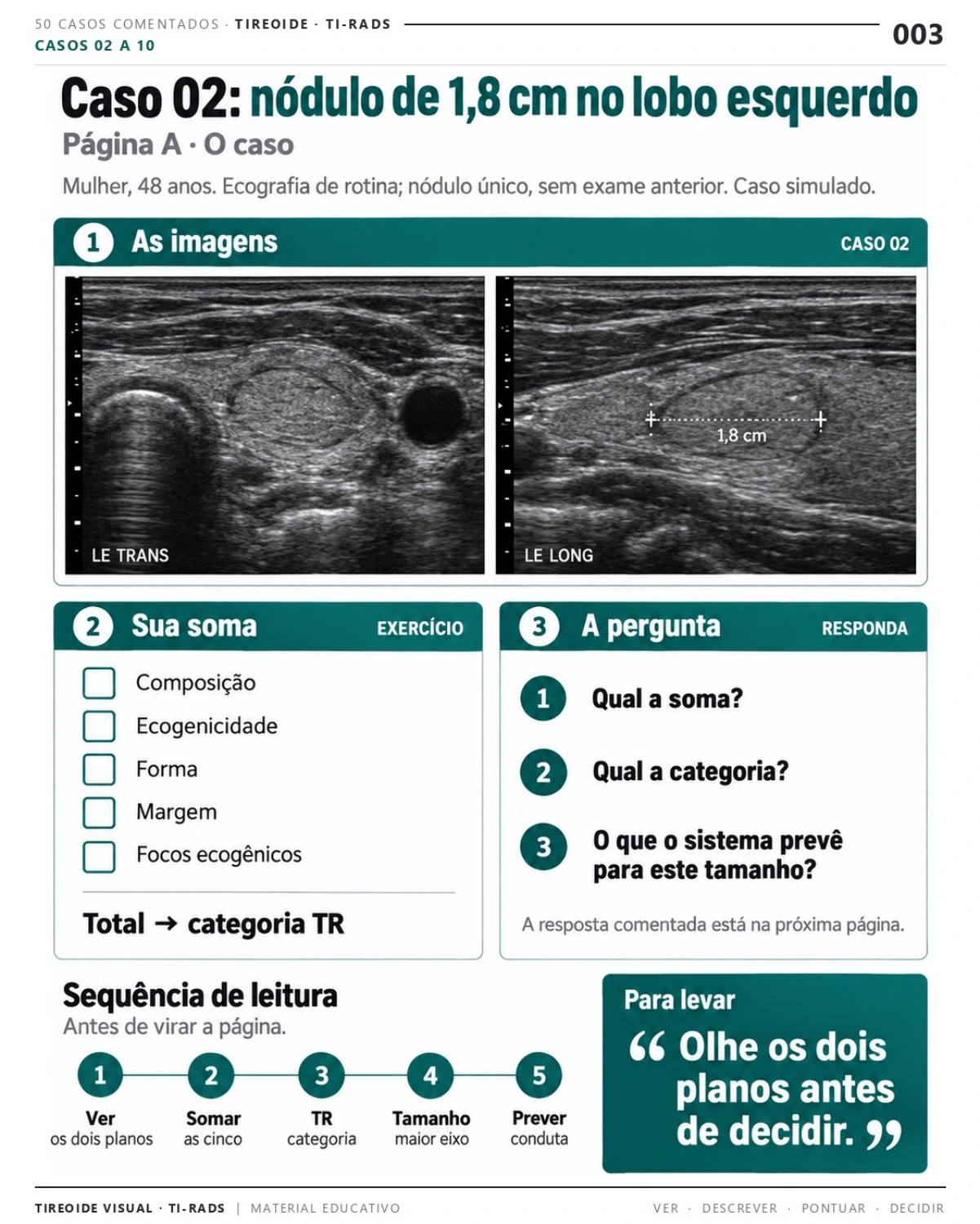 Página 3: Caso 02: nódulo de 1,8 cm no lobo esquerdo. Prévia do PDF Tireoide Visual TI-RADS; imagens didáticas simuladas.